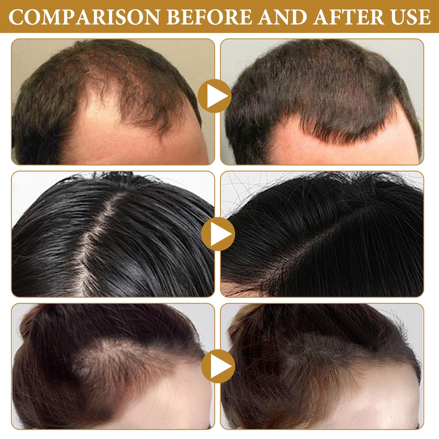 Biotin Hair Spray Repair Hair (imported from germany)