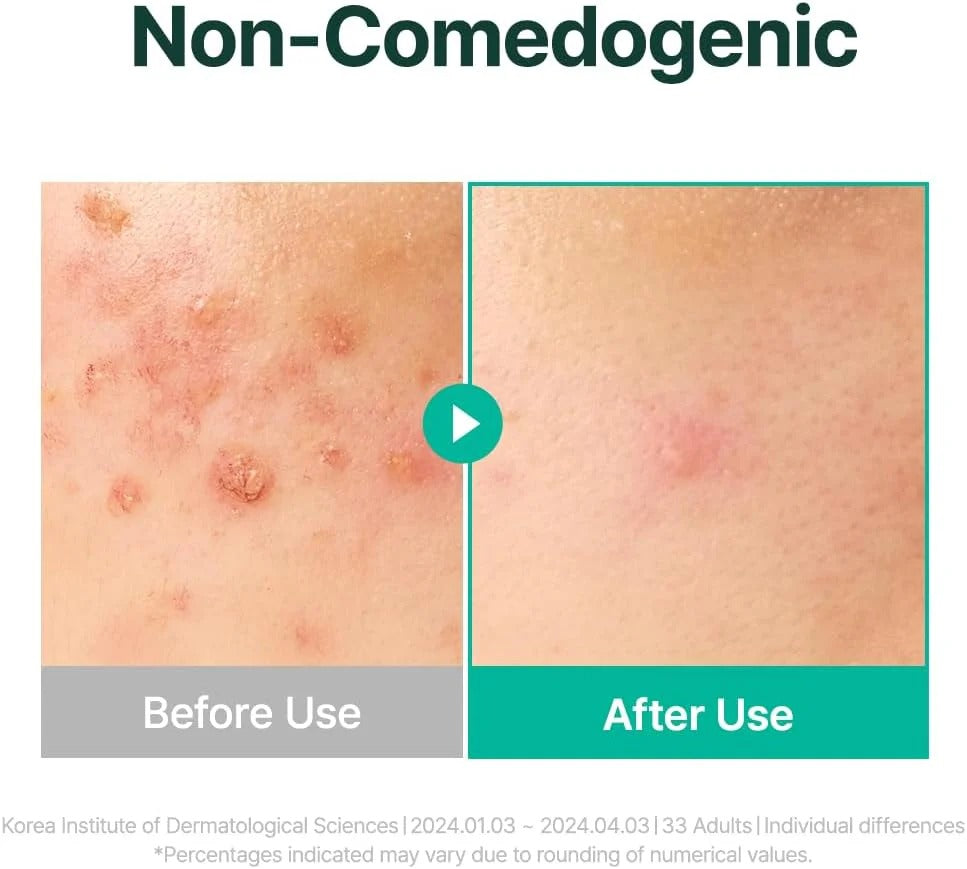 Purito Mighty Bamboo Panthenol Cream Buy 1 Get 1 Free